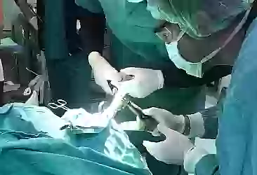 Doktorlar insan vücudundan canlı yılan balığı çıkardı