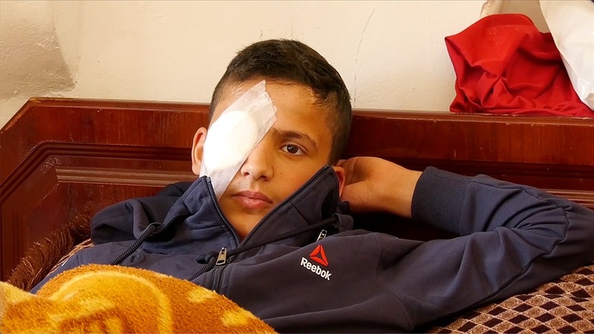 13 yaşındaki çocuk gözünü kaybetti!