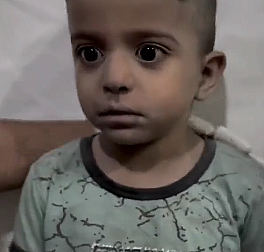 Korkudan titreyen Filistinli çocuğa doktordan şefkat