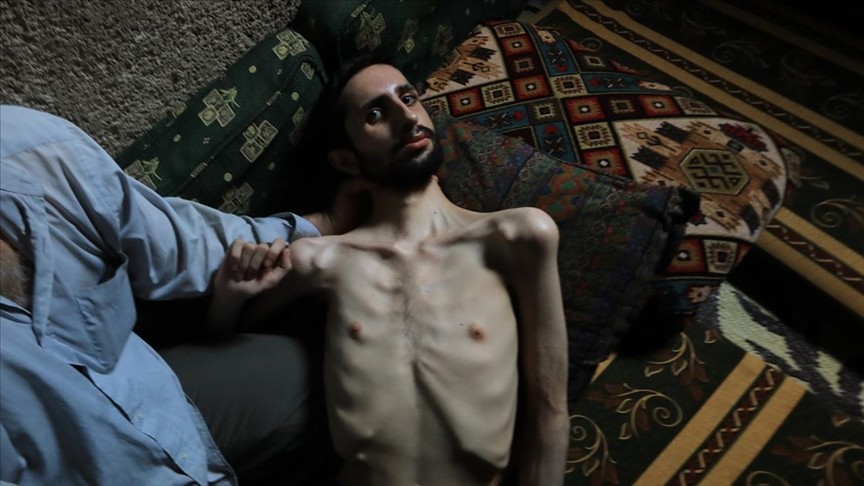 Esed rejimi sakat ve evsiz bıraktı