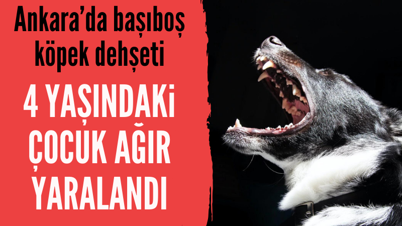 Ankara'da başıboş köpekler küçük çocuğa saldırdı