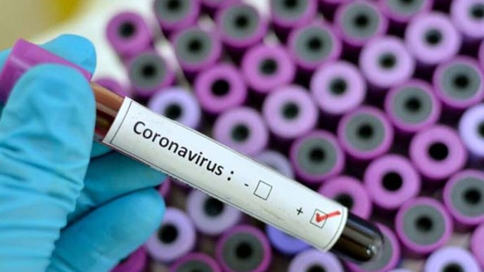 Koronavirüsün uzun süreli 15 belirtisi açıklandı!