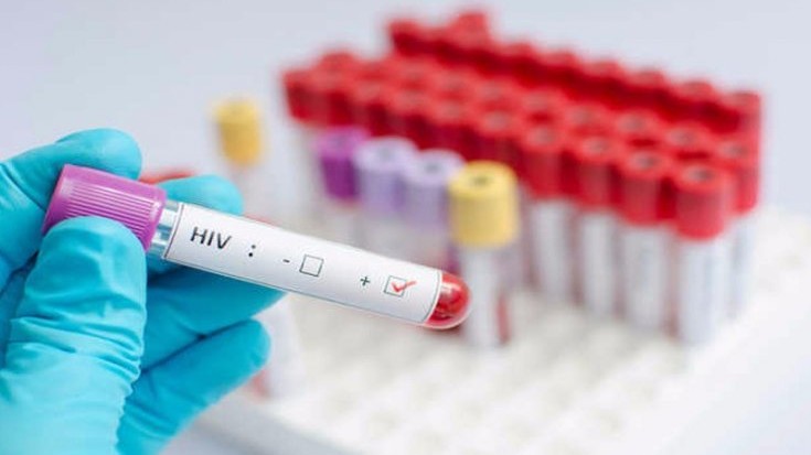 Zambiya'da 1,3 milyon kişi HIV virüsü taşıyor