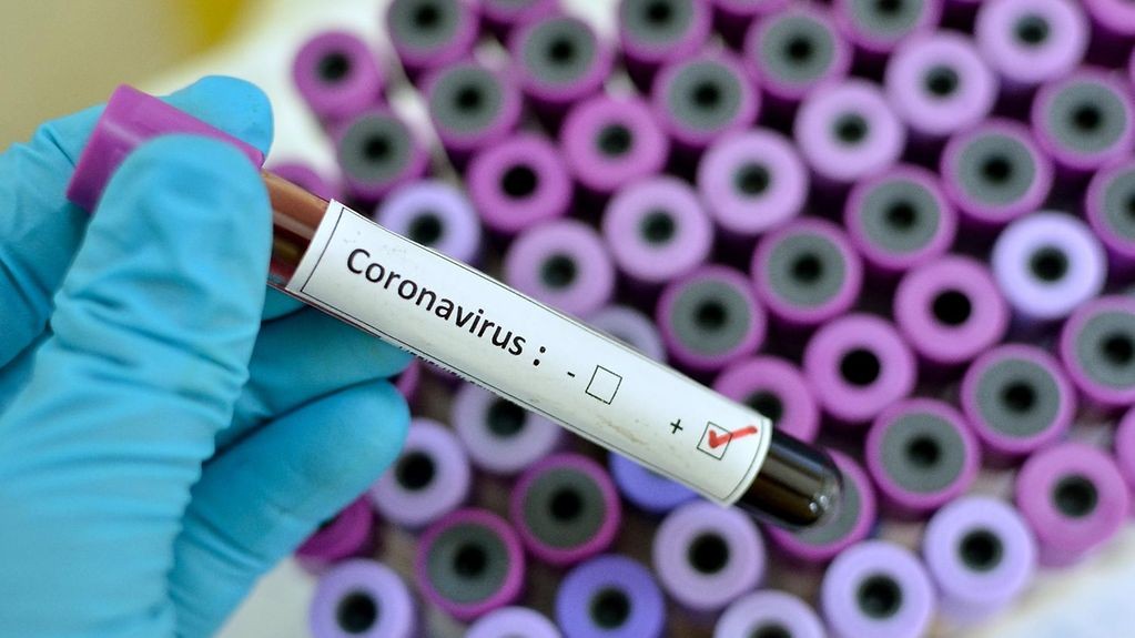 Koranavirüsle mücadelede yeni gelişme!