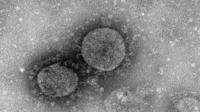 20 soruda yeni koronavirüs salgını